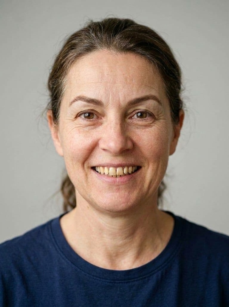 Brow lift example — after