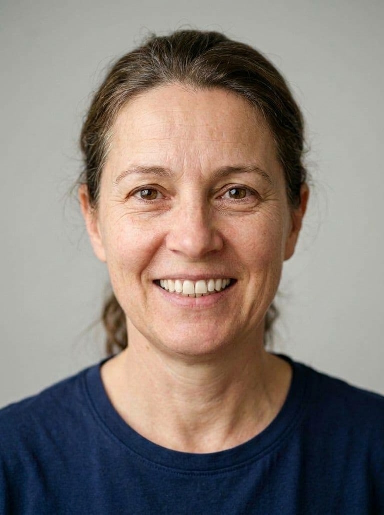 Smile design example — after
